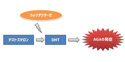AGA発症の仕組み(DHT・5αリダクターゼが原因)